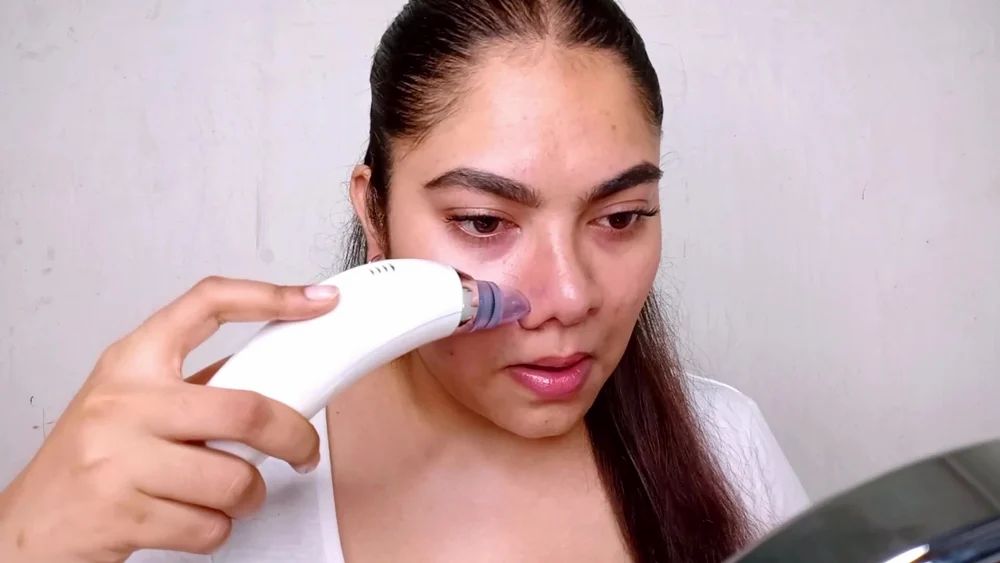 Derma Suction Blackhead Remover